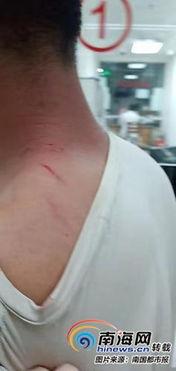 海口情侣吃瓜事件,一场甜蜜误会引发的社交热议