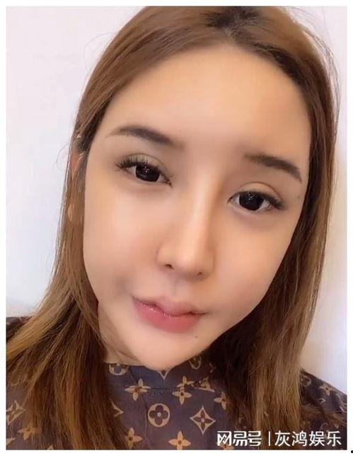 网红下巴变形了,揭秘整形美容的潜在风险