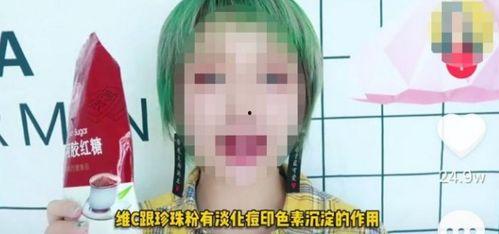 抖音天津网红唐痘痘,魅力四溢的津门新宠