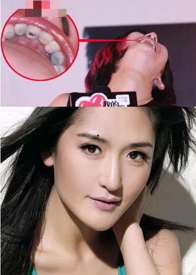 明星牙洞,揭秘明星们的独特微笑秘密