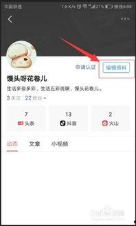 你的头条名称可以修改吗